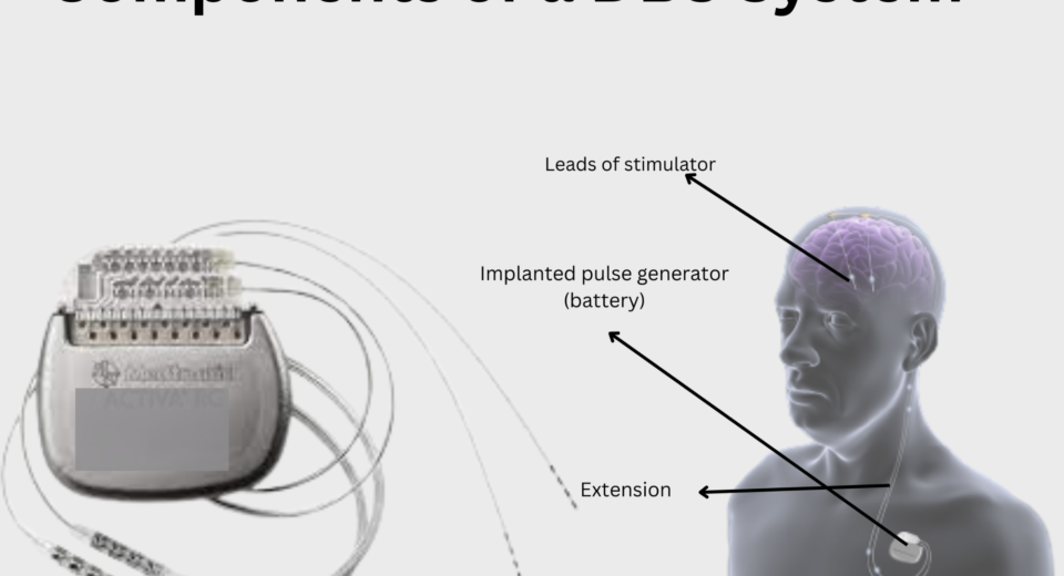 Components Of DBS System