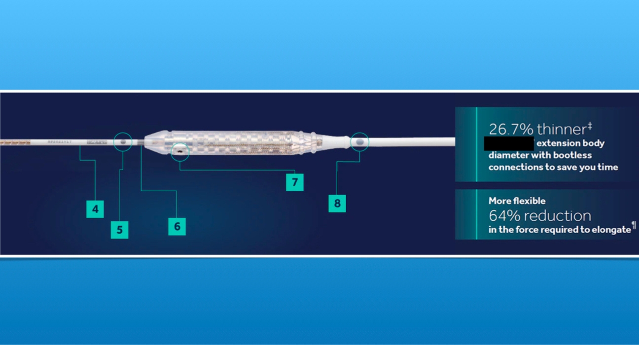 What are the recent advances in DBS surgeries?